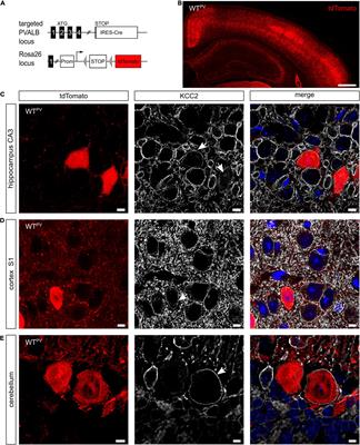 Disruption of KCC2 in Parvalbumin-Positive Interneurons Is Associated With a Decreased Seizure Threshold and a Progressive Loss of Parvalbumin-Positive Interneurons